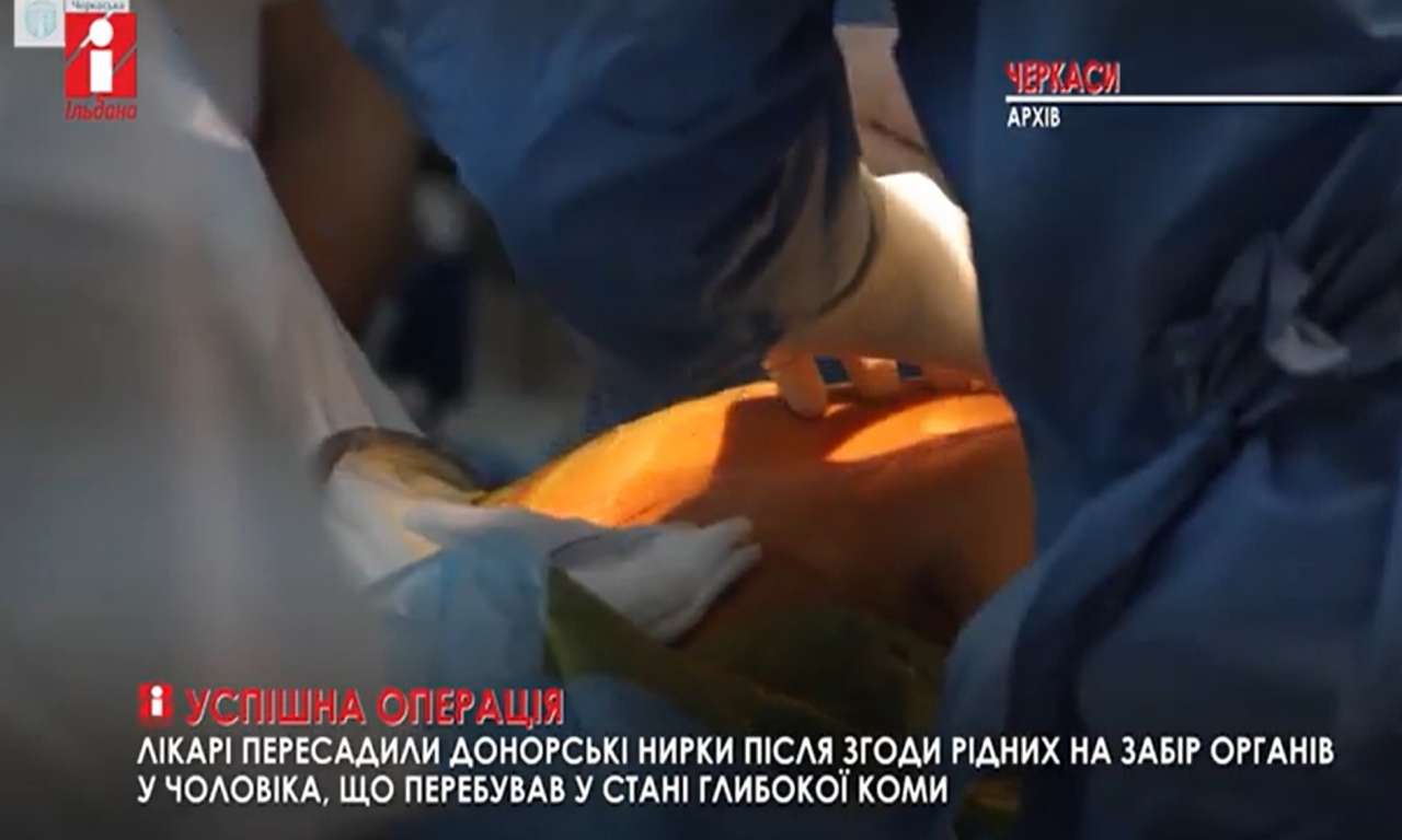 Два врятованих життя: черкаські лікарі пересадили донорські нирки (ВІДЕО)